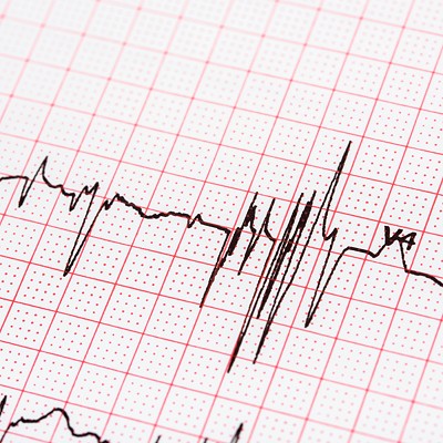 Prairie Cardiovascular adds new atrial fibrillation treatment